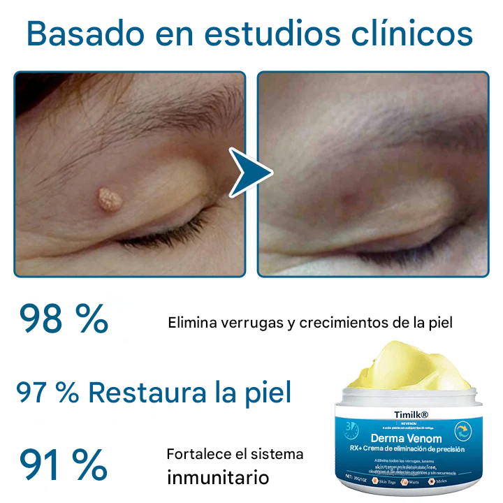 Crema de eliminación de precisión Timilk® DermaVenom RX+