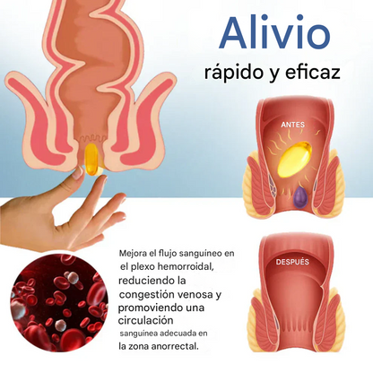 Cápsulas naturales para hemorroides Fivfivgo®