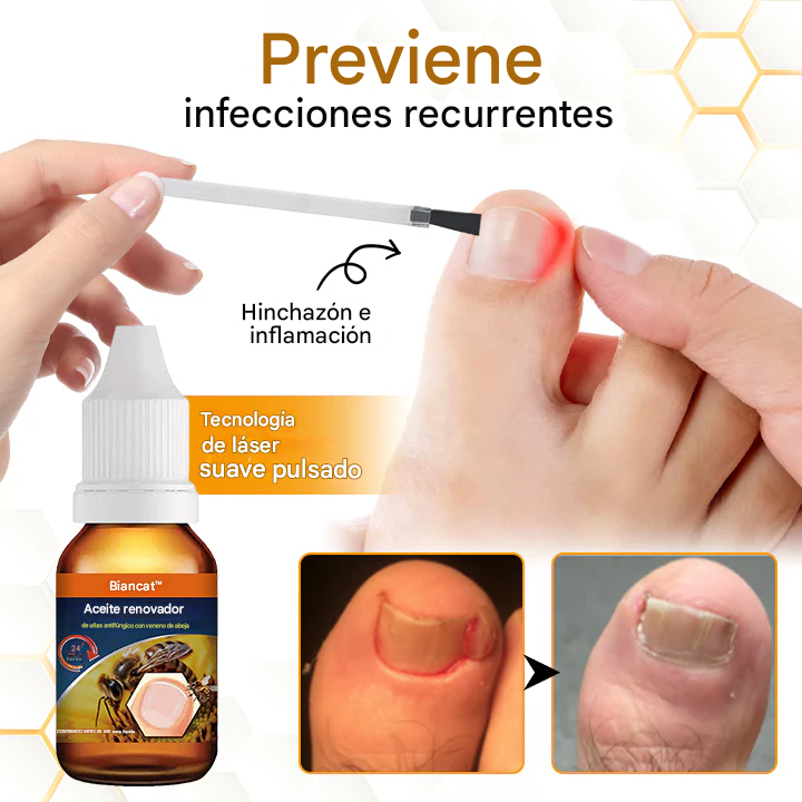 Aceite revitalizante antifúngico para uñas con veneno de abeja