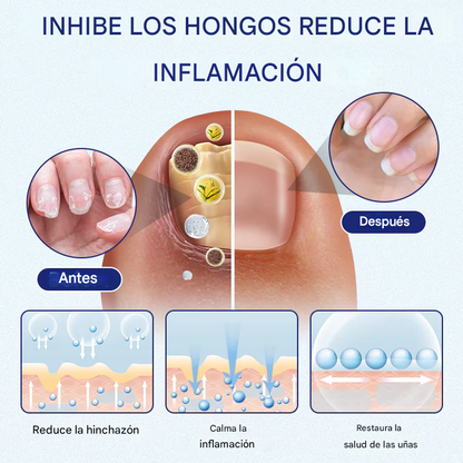 Crema reparadora Timilk® DermaSooth