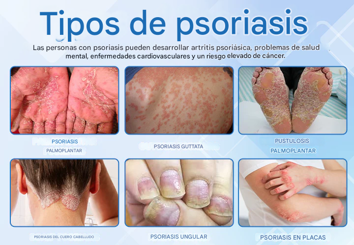 Timilk® DermaMag Magnesium Repair Spray 🔥