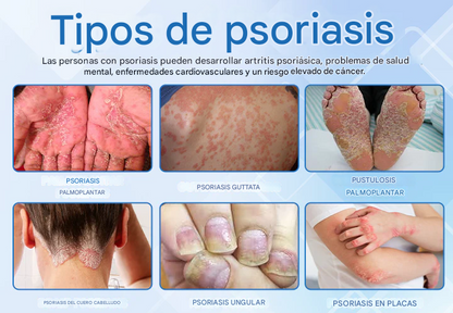 Timilk® DermaMag Magnesium Repair Spray 🔥