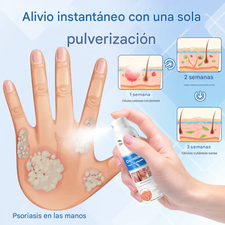 Timilk® DermaMag Magnesium Repair Spray 🔥