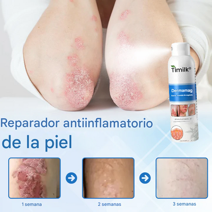 Timilk® DermaMag Magnesium Repair Spray 🔥