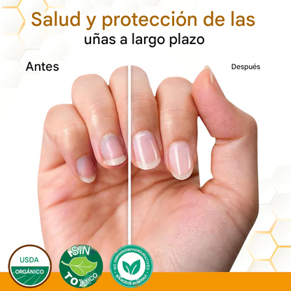 Aceite revitalizante antifúngico para uñas con veneno de abeja