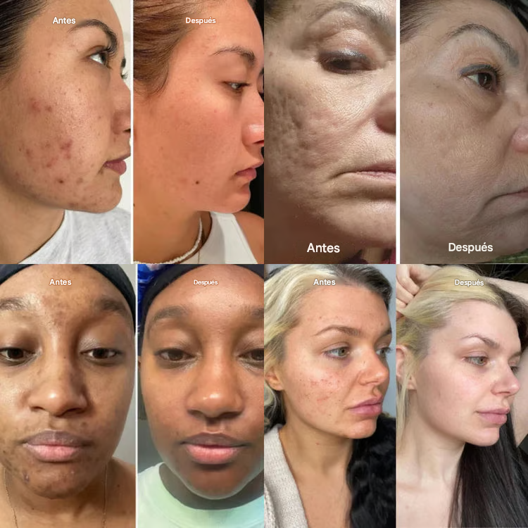 ✨ Crema reafirmante instantánea para el cuello — 🧴 Enriquecida con retinol y ácido hialurónico | Reafirma el cuello, reduce las arrugas y la papada