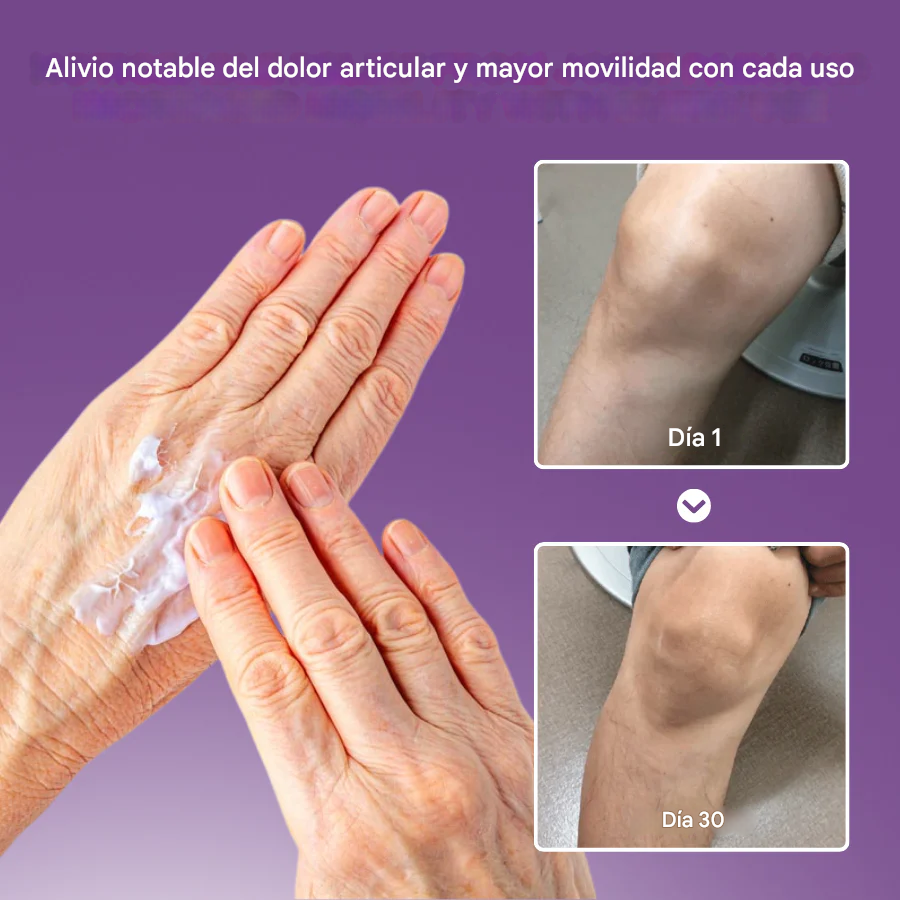 PAGUE 1 LLEVE 2 Gel calmante para el dolor de artritis NovaRX® con cúrcuma y aceite de emú