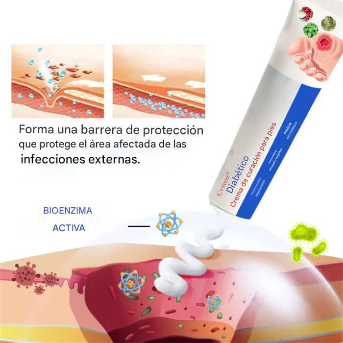 Crema cicatrizante para úlceras del pie diabético Cvreoz®