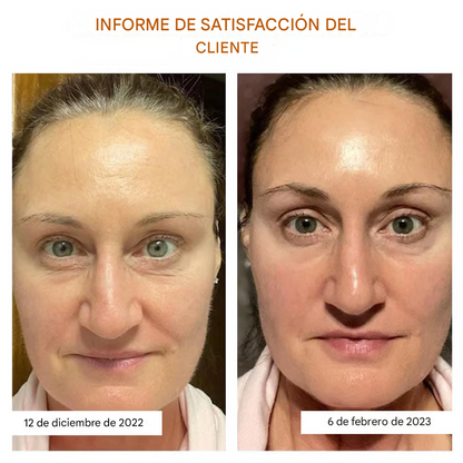 colágeno soluble con tecnología coreana Dermalayr de LOVILDS™