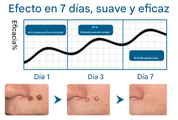 Crema de eliminación de precisión Timilk® DermaVenom RX+
