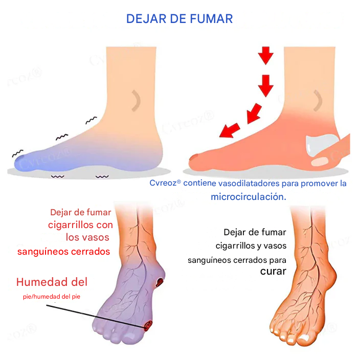 Crema cicatrizante para úlceras del pie diabético Cvreoz®
