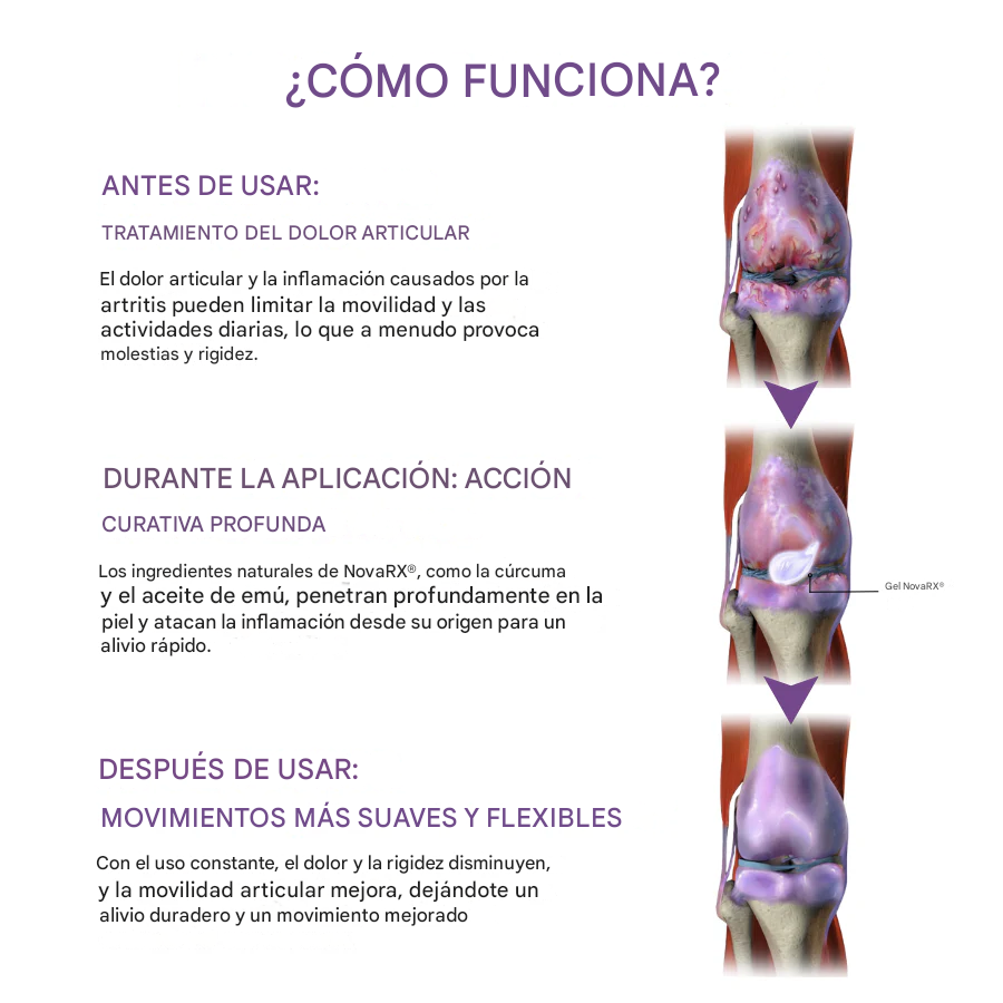 PAGUE 1 LLEVE 2 Gel calmante para el dolor de artritis NovaRX® con cúrcuma y aceite de emú