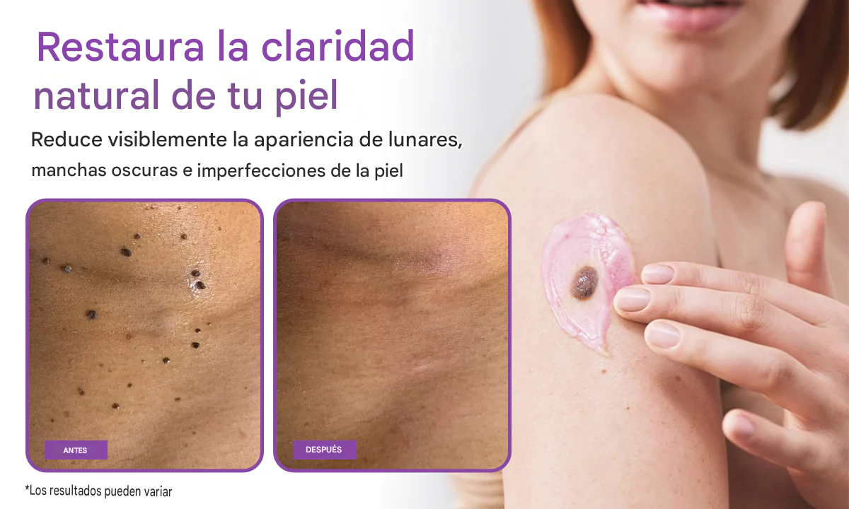 DermaClear Bio-Gel para la eliminación de lunares y manchas oscuras