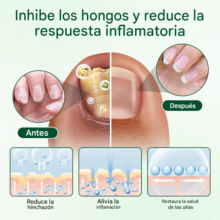 Gel reparador y nutritivo para uñas💅