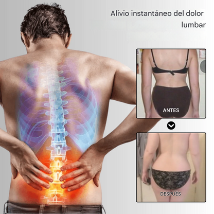 Crema para aliviar el dolor ciático NovaRX®