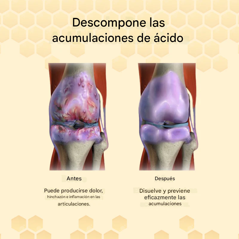 Paga 10 Lleva 40 Parches para el tratamiento de articulaciones con veneno de abeja