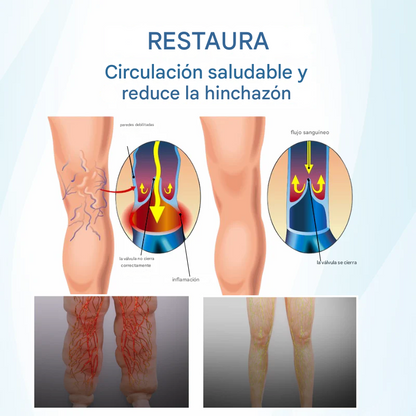 TIMILK® THERAVEIN SPRAY HERBAL PARA VARICES