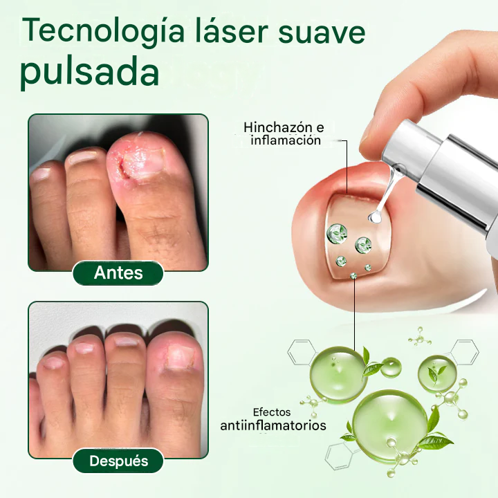 Gel reparador y nutritivo para uñas💅