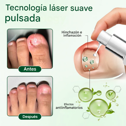 Gel reparador y nutritivo para uñas💅