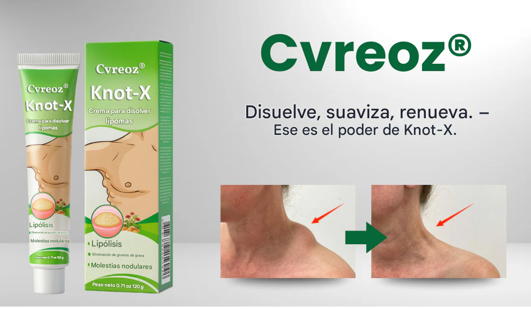 Crema para lipomas Cvreoz® Knot-X