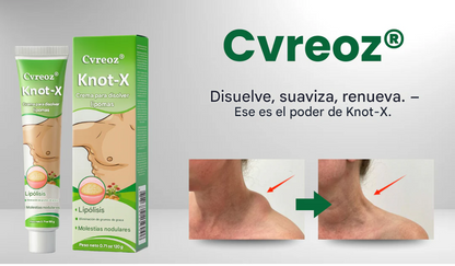 Crema para lipomas Cvreoz® Knot-X