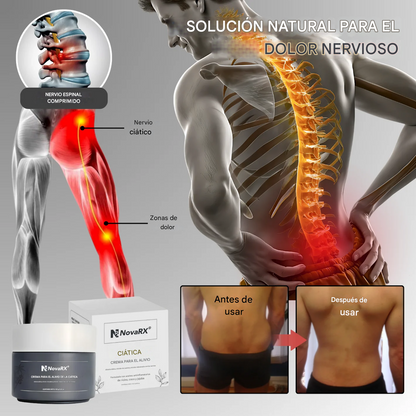 Crema para aliviar el dolor ciático NovaRX®