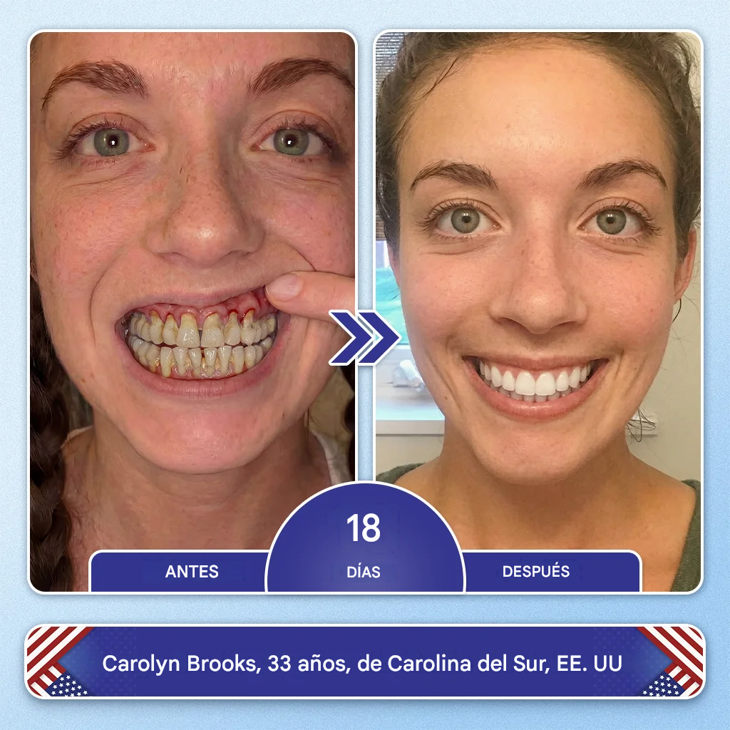 Caja x 7 Parches reparadores de dientes y encías ROSOPL® | Tratamiento de regeneración dental de grado clínico