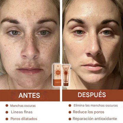 Mascarilla facial exfoliante a base de hierbas Fivfivgo® para manchas