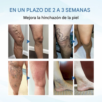 TIMILK® THERAVEIN SPRAY HERBAL PARA VARICES