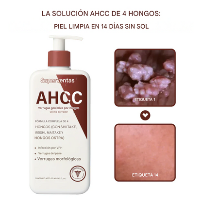 Crema eliminadora de verrugas genitales por hongos Oveallgo® AHCC