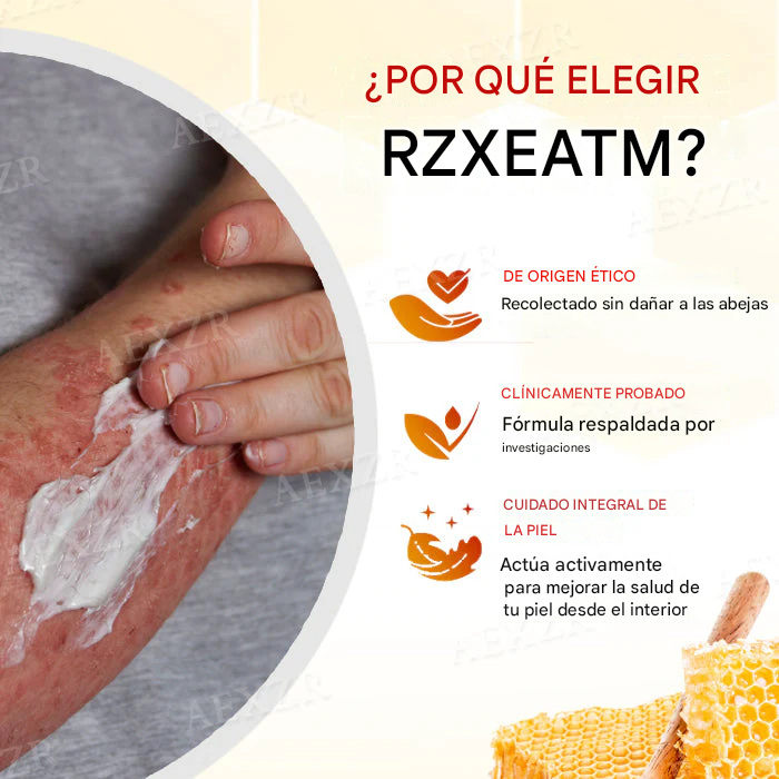 Crema para el tratamiento de la psoriasis con veneno de abeja