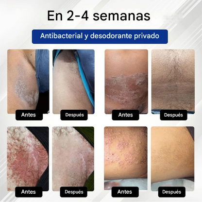 Crema antimicótica genital masculina SEALAYEA® LicorRelief