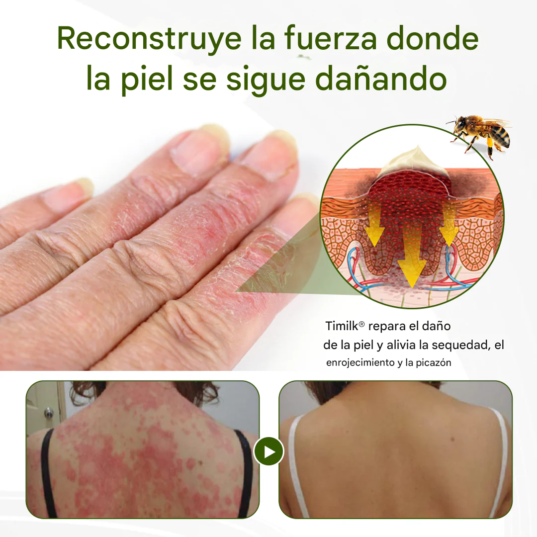 Crema Timilk® BeePeptide RootSoft DualRelief