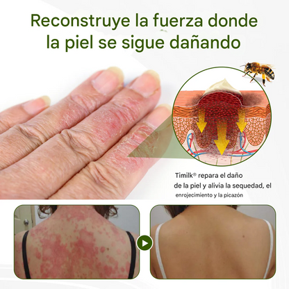 Crema Timilk® BeePeptide RootSoft DualRelief