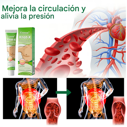 Crema para lipomas Cvreoz® Knot-X