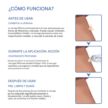 Crema para eliminar verrugas filiformes faciales Fivfivgo® HPV
