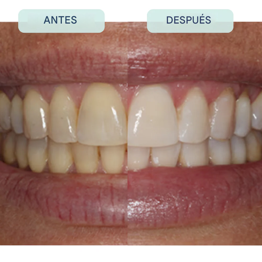 Pasta de dientes Remineralizante Repair