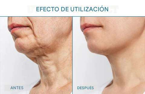 Manteca de juventud reafirmante para la piel Biancat™ LuxeLift