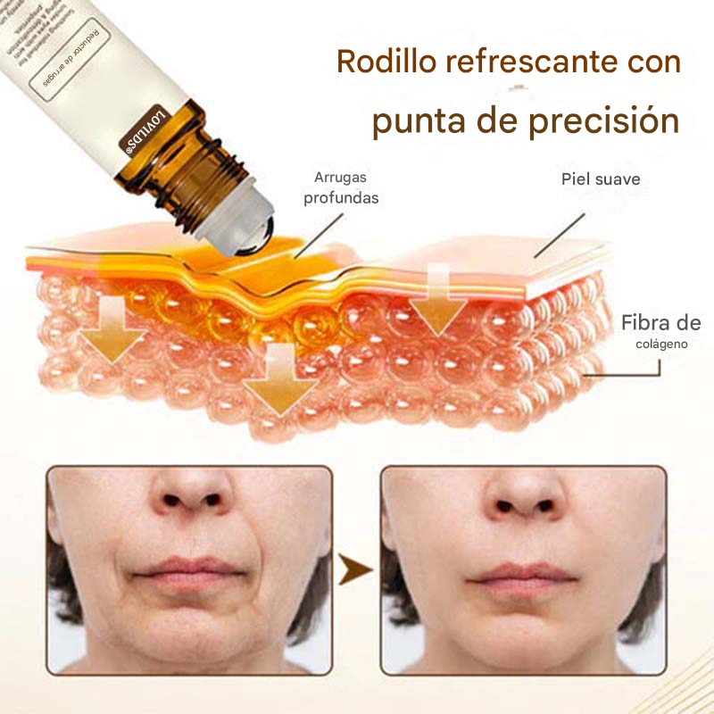 Reductor de arrugas Lovilds® 10s