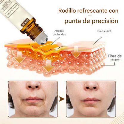 Reductor de arrugas Lovilds® 10s