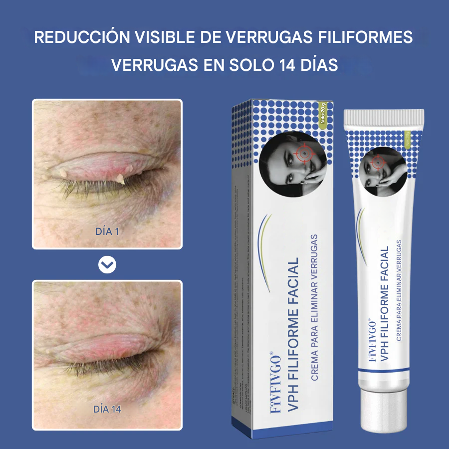Crema para eliminar verrugas filiformes faciales Fivfivgo® HPV
