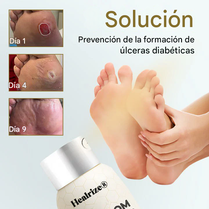 Healrize® Spray curativo para pies diabéticos con veneno de abeja