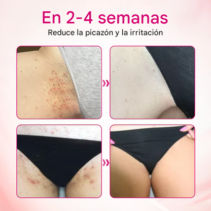 Gel de interferón anti-VPH IntiDefend