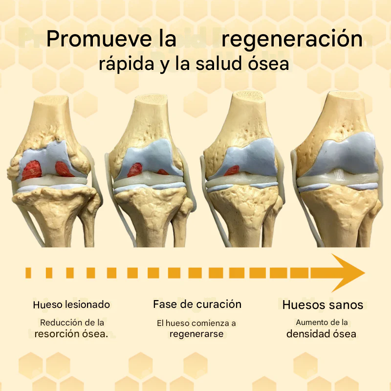 Paga 10 Lleva 40 Parches para el tratamiento de articulaciones con veneno de abeja