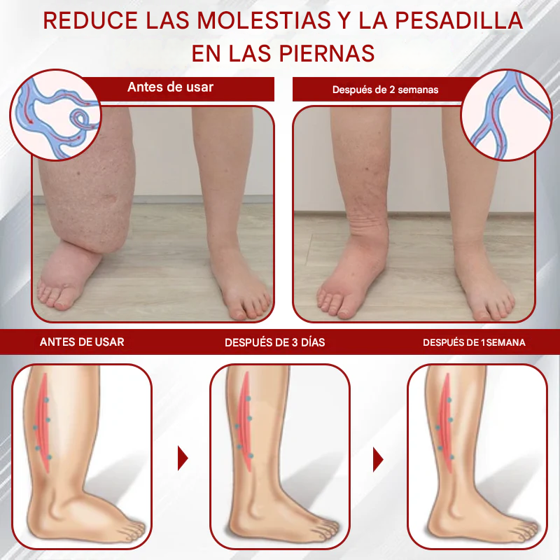 Crema de masaje para drenaje linfático ATTDX® EdemaCare