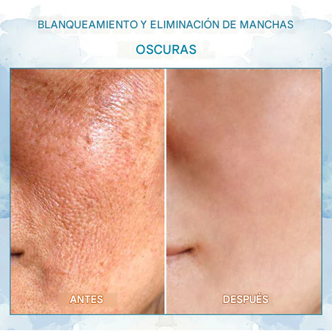 Manteca de juventud reafirmante para la piel Biancat™ LuxeLift