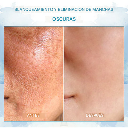 Manteca de juventud reafirmante para la piel Biancat™ LuxeLift