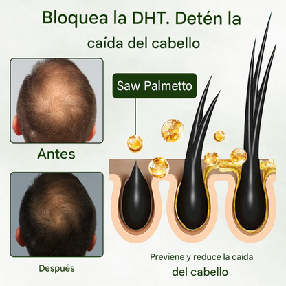 Timilk® Follicure BioGrow Spray Restaurador Capilar (Reactiva tus raíces. Regenera tu cabello de forma natural. ✨ Recuperación del cabello clínicamente comprobada en 4 semanas ✨)