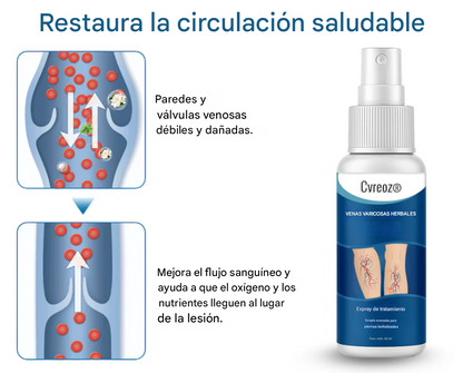 Resultados visibles en 7 días + Atenúa las arañas vasculares rápidamente✨Cvreoz® Spray de tratamiento herbal para venas varicosas