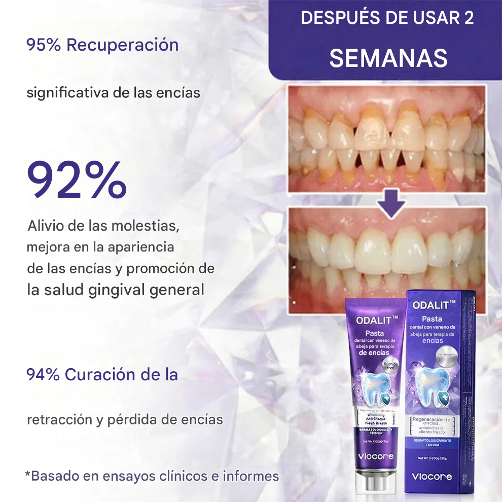 Pasta dental ODALIT™ VioCore con veneno de abeja para tratamiento dental